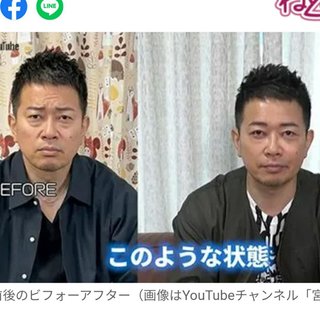 宮迫博之、整形前の方がよくない？