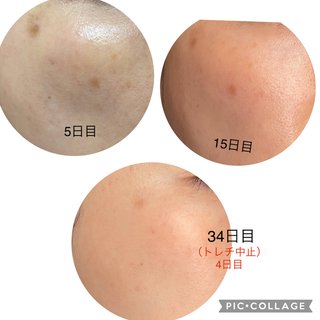 ★ﾁﾗ裏inﾋﾞｭｰﾃｨ/ﾌｧｯｼﾖﾝ糧★