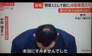 中田翔、ハゲていた