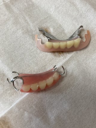 歯医者さんいますか 入れ歯の話