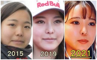 高梨沙羅ちゃん