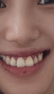 いしだ壱成の嫁 飯村貴子