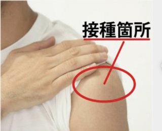 ワクチン接種で腫れた人、どこに打たれましたか??