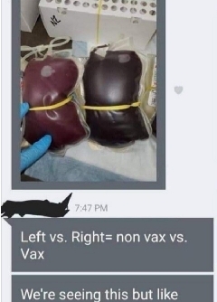 米国、日本赤十字社、ワクチン接種者の黒い血液献血受付拒否、禁止