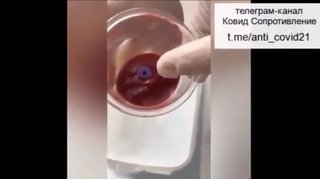 うわ、  ワクチン接種後、62％が血栓