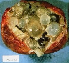 北海道の致死の危険性がある寄生虫疾患【エキノコックス症】が愛知県でも発見