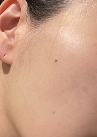 何歳の肌だと思いますか？