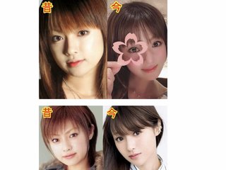 深田恭子　ロレツが回らない理由は度重なる美容整形？