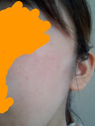 何歳の肌だと思いますか？