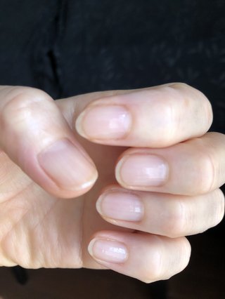 どうでもいい報告してください