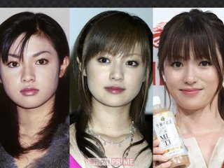 深田恭子　ロレツが回らない理由は度重なる美容整形？