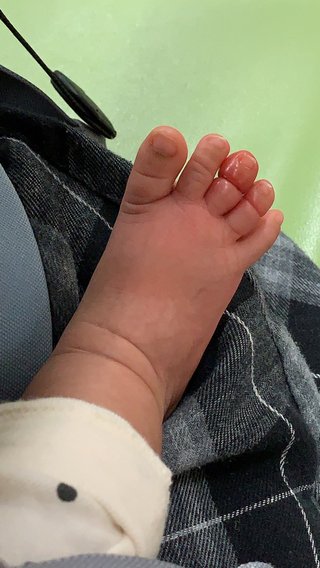 紺野あさ美、たかが髪の毛1本→赤ちゃんには“脅威”　ヘアターニケット”で病院はしご　