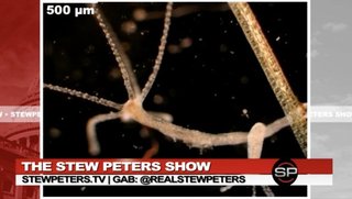 ファイザーワクチンに寄生虫が発見『この生物は組織を破壊し、血を吸う』