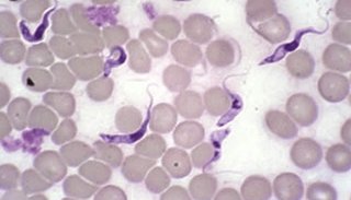 ファイザーワクチンに寄生虫が発見『この生物は組織を破壊し、血を吸う』