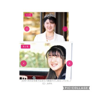 愛子様の歯列矯正は。。