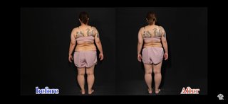 美奈子の脂肪吸引の動画見たら太らないって決めた