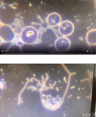 ワクチンの中に入っているヒドラは、しっかりと血液中でも生きています。不死身です(￣▽￣;)