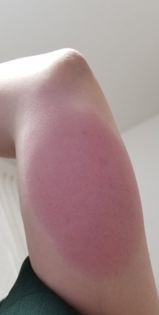 今日インフルエンザワクチン打ってきたよ。みんな打った？