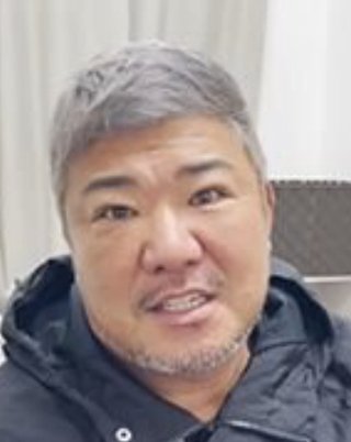 亀田史郎、56歳で二重まぶたへの“ガチ美容整形”に挑戦　パッチリ目元には賛否