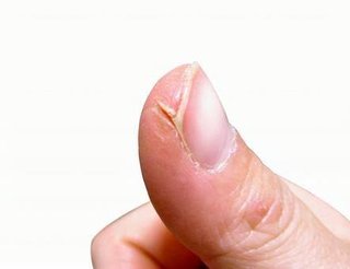 どうでもいい報告してください