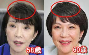 内村航平｢五輪がなくなれば死ぬかもしれない。」と国民を脅迫