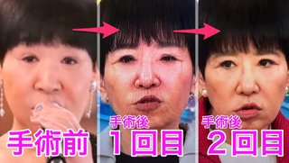 アッコにおまかせ