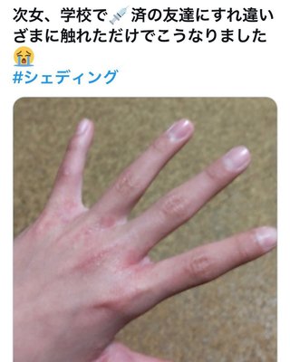 次女、学校でワクチン   シェディング