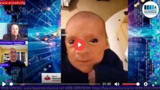 ワクチン打って生まれた産婦の赤ちゃん目玉が奇妙