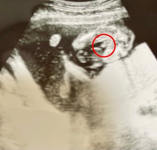 男の子と言われて女の子という場合はあるんですか？