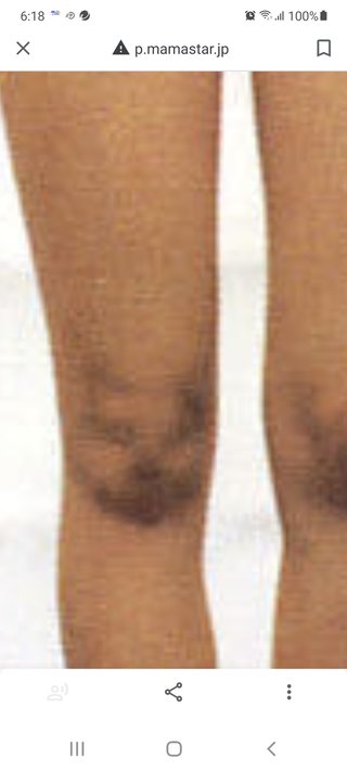 こんな人もグラビアやってたんだと驚いた