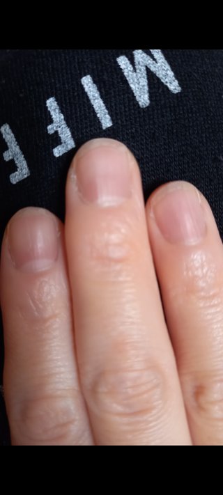 爪、これだけ伸びるともう気持ち悪いー