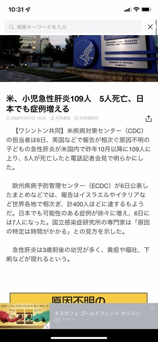 子供の急性肝炎増えたね アメリカは100人罹って5人死亡だって