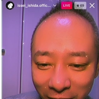 いしだ壱成「植毛」関係なし？　“自信回復”で女性３人から言い寄られるモテっぷり