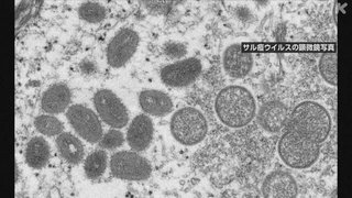 「サル痘」感染や疑いの報告相次ぐ 各国の保健当局拡大に警戒