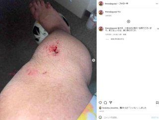 ジャガー横田15歳長男の「ぐにゃり足指」に騒然　「折れてる？」「嘘でしょ」心配相次ぐ