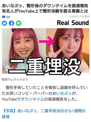 あいなぷぅがとうとう二重にしてちょっと可愛くなった