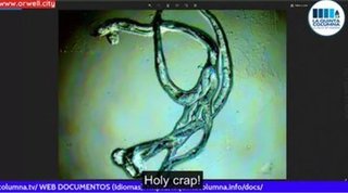 セヴィラーノ医師、ファイザー製ワクチンサンプルから新たな奇妙な「生命体」を発見