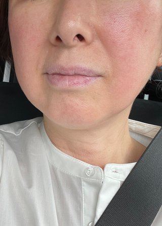 元おニャン子・内海和子、顔が真っ赤になる謎の症状を報告「数日まえから透明なポツポツが」