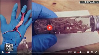 毒ワクチンのナノ生物   これ 地球の生物じゃない