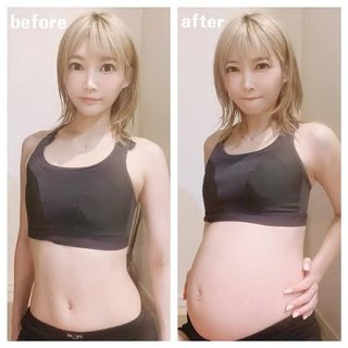 胃下垂の女の子のお腹