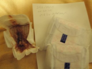 アラサーを追い回し「おばあちゃん」連呼する犯人は69歳愛美お婆さん