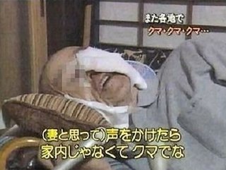 【北海道】クマに襲われ「死んじゃうかと」肋骨折れ100針以上の大ケガ…恐怖の一部始終