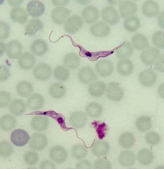 米科学者「ファイザー社製ワクチン」から免疫系を麻痺させる致死的な寄生虫を発見