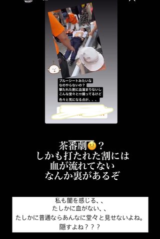  安倍氏銃撃、作動しないＡＥＤ、救命措置の一部始終