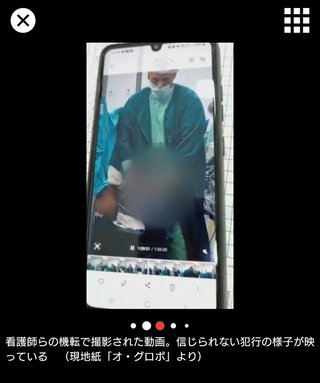 帝王切開中に女性の口に男性器を突っ込んで自慰行為