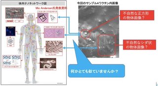 奴らは  毒ワクチン接種を煽る華僑工作員だよww