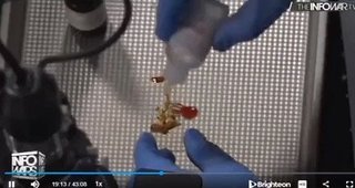 これこれ！ワクチン打ちの人の体に居る生物。葬儀屋さん証言！＠実物公開している