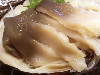 医療脱毛でvioしてる人