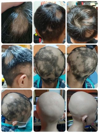 李氏( レビ氏ユダヤ人)、華僑たちが毒ワクチンをあおって日本人大虐殺企画