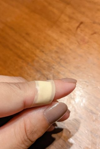 大怪我をしてしまい大変申し上げにくいんですが本日ママスタをお休みさせて頂きます